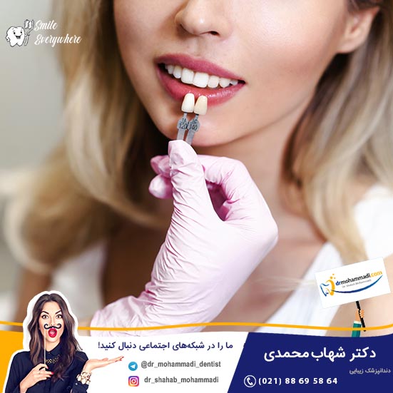 آیا امکان دارد فقط تعداد کمی از دندان هایم را لمینیت کنم؟ - کلینیک دندانپزشکی دکتر شهاب محمدی
